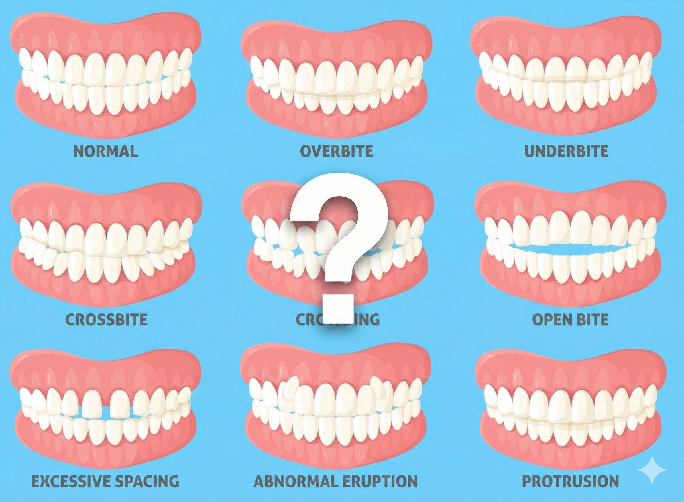 Who Needs Orthodontic Treatment?