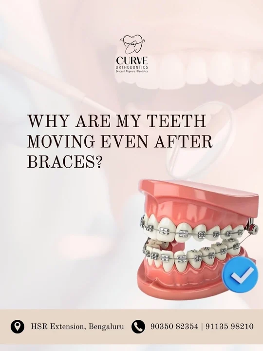 At Curve, we often hear patients wonder why their teeth seem to move even after braces. This is more common than you…